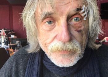 Drama: Johan Derksen gewond na ongeluk (+FOTO’S)