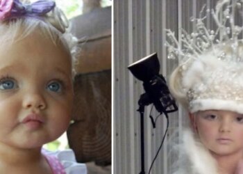 Dit 2-jarige meisje werd vroeger altijd een pop genoemd – Zie hoe ze er nu uitziet