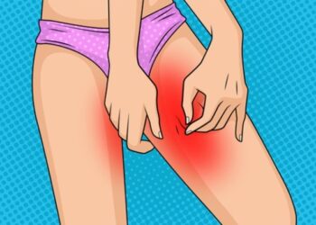 SUPERTIP: Schurende bovenbenen in de zomer voorkom je met deze simpele truc