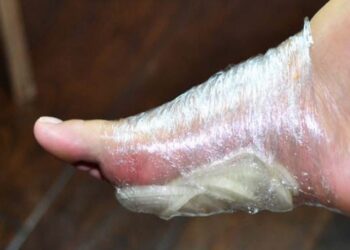 Ze stopt een ui in haar sok voordat ze gaat slapen. De reden? Dit is geweldig!