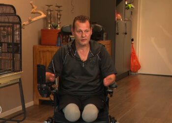 BEELDEN: Michael werd wakker zonder armen en benen, nu wil hij weer stratenmaker worden